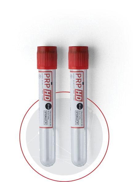 PRP HD TUBES – Hochwertige Röhrchen für die Gewinnung von plättchenreichem Plasma